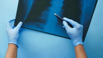 Sokakat fenyeget, kevesen tudnak erről a tüdőbetegségről